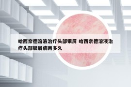 哈西奈德溶液治疗头部银屑 哈西奈德溶液治疗头部银屑病用多久