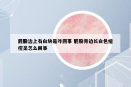 屁股边上有白块是咋回事 屁股旁边长白色痘痘是怎么回事