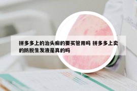 拼多多上的治头癣的要买管用吗 拼多多上卖的防脱生发液是真的吗