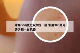 家用308激光多少钱一台 家用308激光多少钱一台机器