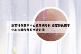 空军特色医学中心银屑病专科 空军特色医学中心皮肤科专家出诊时间