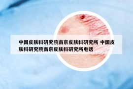 中国皮肤科研究院南京皮肤科研究所 中国皮肤科研究院南京皮肤科研究所电话