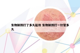 生物制剂打了多久起效 生物制剂打一针管多久