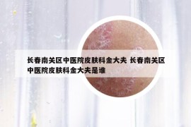 长春南关区中医院皮肤科金大夫 长春南关区中医院皮肤科金大夫是谁