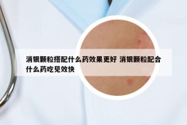 消银颗粒搭配什么药效果更好 消银颗粒配合什么药吃见效快