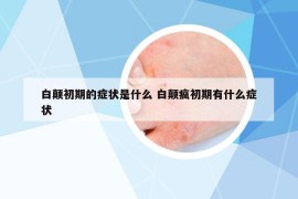 白颠初期的症状是什么 白颠疯初期有什么症状