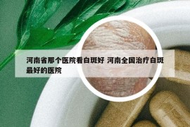 河南省那个医院看白斑好 河南全国治疗白斑最好的医院