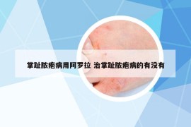 掌趾脓疱病用阿罗拉 治掌趾脓疱病的有没有