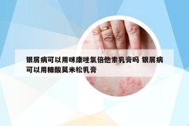 银屑病可以用咪康唑氯倍他索乳膏吗 银屑病可以用糠酸莫米松乳膏