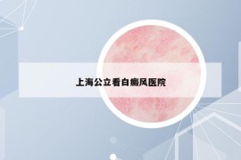 上海公立看白癜风医院