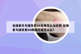 谷维素片与维生素b6合用怎么治白斑 谷维素与维生素b6同服作用可以么?