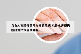 乌鲁木齐现代医院治疗银屑病 乌鲁木齐现代医院治疗银屑病好吗