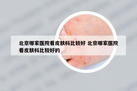 北京哪家医院看皮肤科比较好 北京哪家医院看皮肤科比较好的