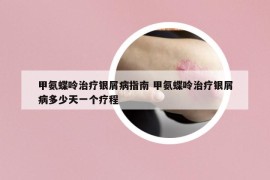 甲氨蝶呤治疗银屑病指南 甲氨蝶呤治疗银屑病多少天一个疗程