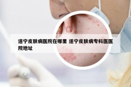 遂宁皮肤病医院在哪里 遂宁皮肤病专科医医院地址