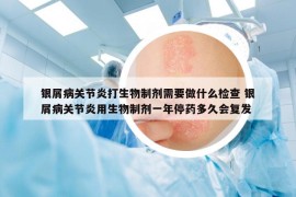 银屑病关节炎打生物制剂需要做什么检查 银屑病关节炎用生物制剂一年停药多久会复发