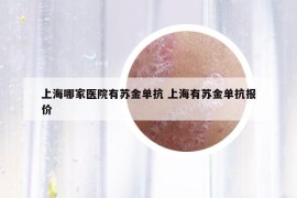 上海哪家医院有苏金单抗 上海有苏金单抗报价