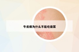 牛皮癣为什么不能吃韭菜