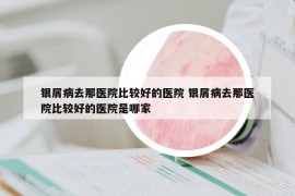银屑病去那医院比较好的医院 银屑病去那医院比较好的医院是哪家