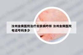 汝州金庚医院治疗皮肤病咋样 汝州金庚医院电话号码多少