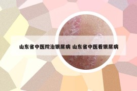 山东省中医院治银屑病 山东省中医看银屑病