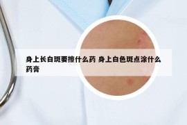 身上长白斑要擦什么药 身上白色斑点涂什么药膏