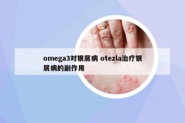 omega3对银屑病 otezla治疗银屑病的副作用