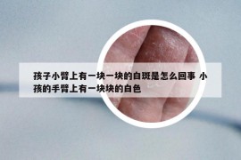 孩子小臂上有一块一块的白斑是怎么回事 小孩的手臂上有一块块的白色