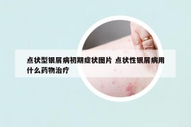 点状型银屑病初期症状图片 点状性银屑病用什么药物治疗