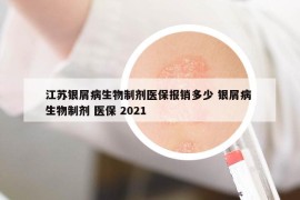 江苏银屑病生物制剂医保报销多少 银屑病 生物制剂 医保 2021