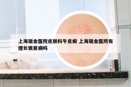 上海瑞金医院皮肤科牛皮癣 上海瑞金医院有擅长银屑病吗
