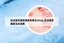 托法替尼银屑病每天两次10mg 托法替尼最新治白进展
