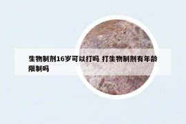 生物制剂16岁可以打吗 打生物制剂有年龄限制吗