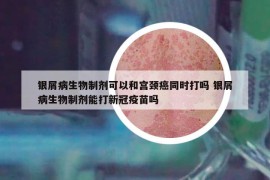 银屑病生物制剂可以和宫颈癌同时打吗 银屑病生物制剂能打新冠疫苗吗