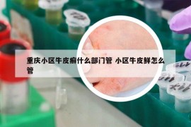 重庆小区牛皮癣什么部门管 小区牛皮鲜怎么管