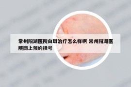 常州阳湖医院白斑治疗怎么样啊 常州阳湖医院网上预约挂号