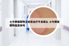 小牛脾提取物注射液治疗牛皮癣么 小牛脾提取物是激素吗