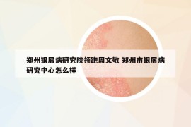 郑州银屑病研究院领跑周文敬 郑州市银屑病研究中心怎么样