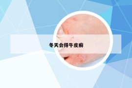 冬天会得牛皮癣