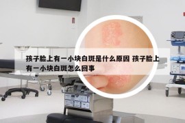 孩子脸上有一小块白斑是什么原因 孩子脸上有一小块白斑怎么回事