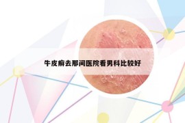 牛皮癣去那间医院看男科比较好