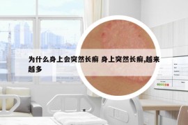 为什么身上会突然长癣 身上突然长癣,越来越多