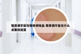 银屑病不能吃哪些调味品 银屑病不能吃什么水果和蔬菜
