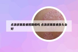 点滴状银屑病初期痒吗 点滴状银屑病多久会好