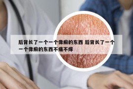 后背长了一个一个像癣的东西 后背长了一个一个像癣的东西不痛不痒