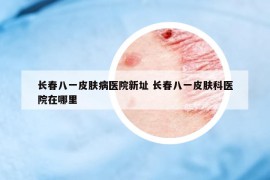 长春八一皮肤病医院新址 长春八一皮肤科医院在哪里