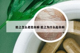 脸上怎么老出白癣 脸上为什么起白癣