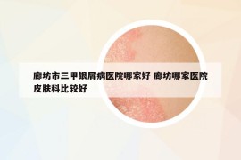 廊坊市三甲银屑病医院哪家好 廊坊哪家医院皮肤科比较好