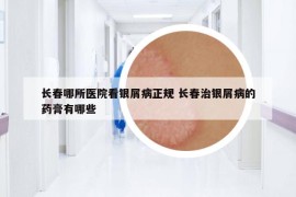 长春哪所医院看银屑病正规 长春治银屑病的药膏有哪些