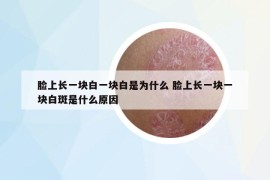 脸上长一块白一块白是为什么 脸上长一块一块白斑是什么原因